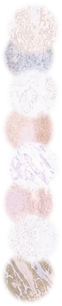 lateral lateral